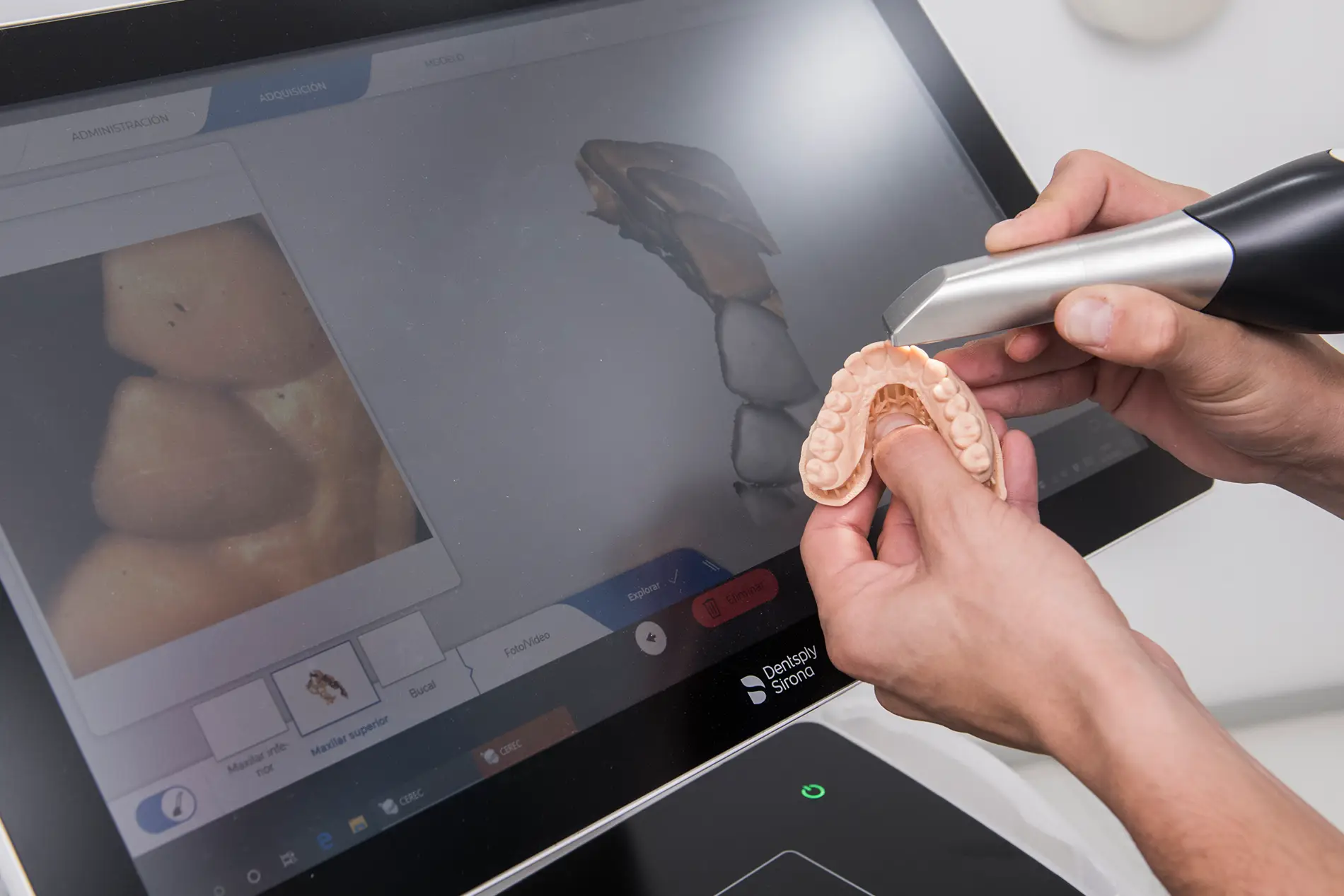 Scanner intra-oral